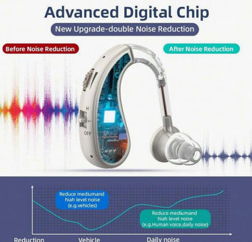 Audexa Hearing Aids™